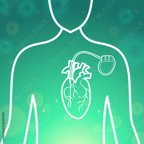 Heart with pacemaker medical wallpaper,vector illustration.Human Heart logo and Heart Pacemaker lifesaver on green blur pattern human silhouette. Medical wallpaper for medical site,cardiology clinic