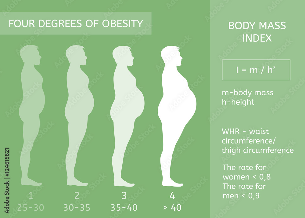 Male Figure In Profile Obesity Stages Body Mass Index Infographics 
