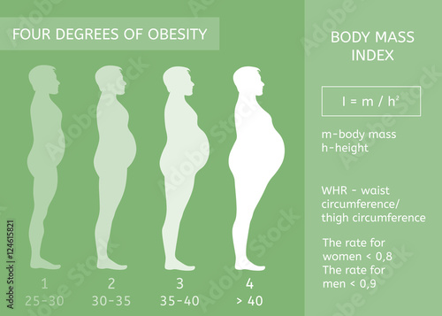 Male figure in profile. Obesity stages. Body mass index. Infographics