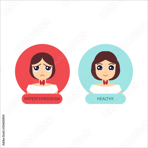 Woman with hyperthyroid gland and healthy woman. Hyperthyroism symbol. Thyroid diagram sign. Medical concept. Anatomy of people. Vector illustration made in cartoon style.