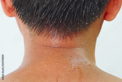 Sweat on the neck of asian man