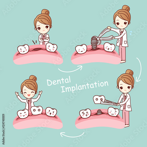 cartoon tooth dental implantation concept