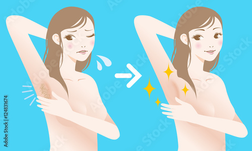 women's underarm hair removal before after concept, unwanted hair, superfluous hair, vector illustration