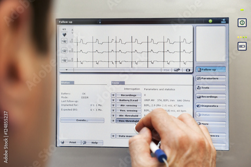 Obraz na plátně Doctor heart pacemaker monitor