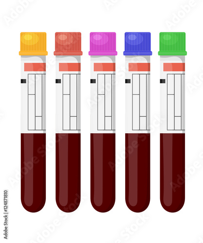 Set of vector illustrations of medical test tubes with colored c