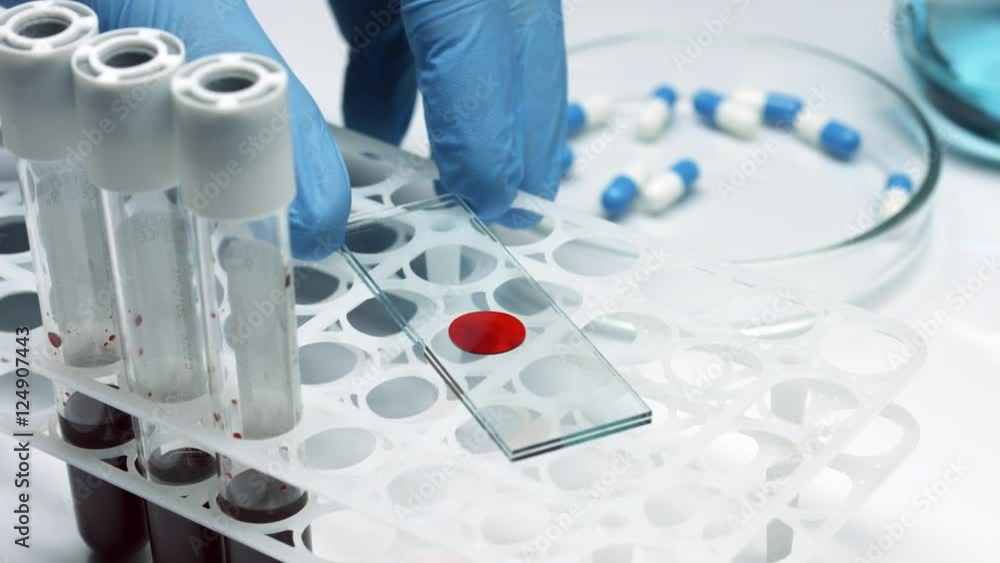 Close up of scientist in blue gloves cover blood drop on slide glass with coverslip, drug testing experiment in laboratory Close up of scientist in blue gloves cover blood drop on slide glass with coverslip, drug testing experiment in laboratory