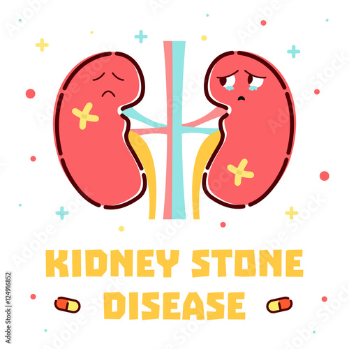 Kidney stone disease awareness poster with sad cartoon kidneys character on white background. Renal stones. Human body organs anatomy icon. Medical concept. Vector illustration.
