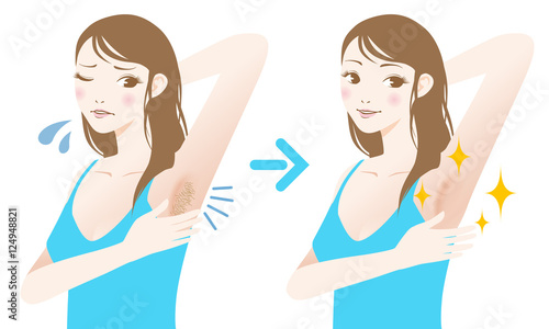 women's underarm hair removal before after concept, unwanted hair, superfluous hair, vector illustration