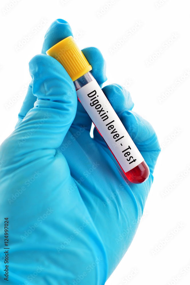 Obraz premium Blood sample for digoxin (drug for heart disease) level test 