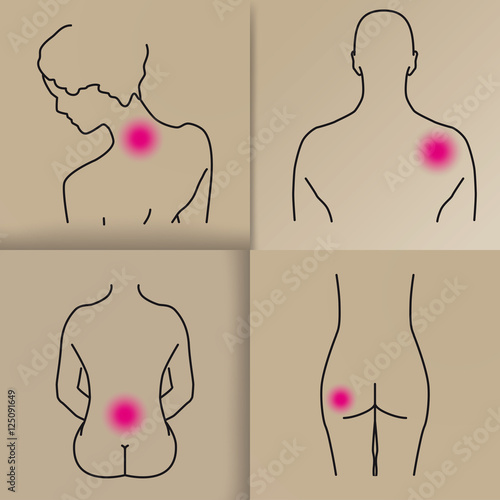 Schmerzpunkte bei Arthrose