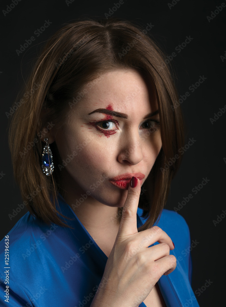 Young beautiful woman with bruises on her face. Young beautiful woman with bruises on her face.