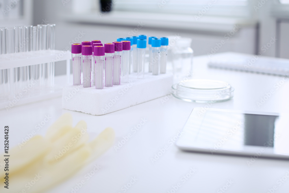 Research laboratory working space. Test tubes and tablet PC are lying at the table. Medical equipment. Blood test Research laboratory working space. Test tubes and tablet PC are lying at the table. Medical equipment. Blood test