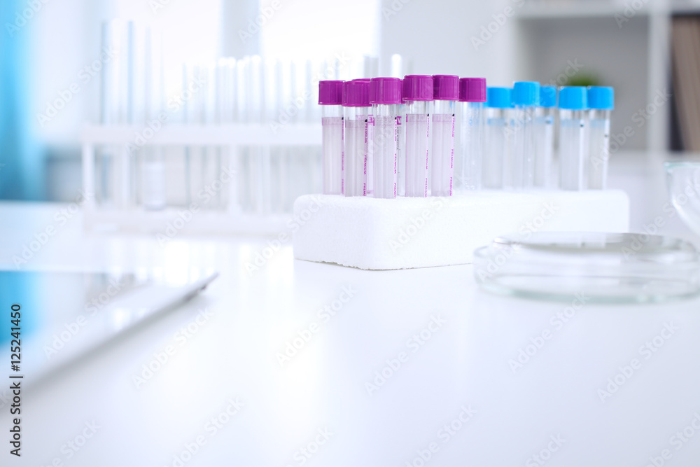 Research laboratory working space. Test tubes and tablet PC are lying at the table. Medical equipment. Blood test Research laboratory working space. Test tubes and tablet PC are lying at the table. Medical equipment. Blood test