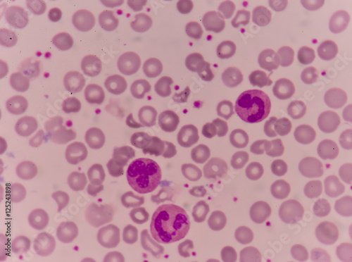 Moderate white blood cells  mature neutrophil and band form neut photo