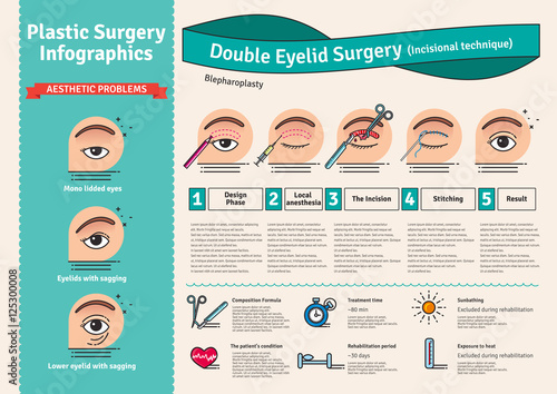 Vector Illustrated set with double eyelid surgery
