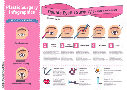 Vector Illustrated set with double eyelid surgery