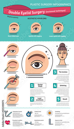 Vector Illustrated set with double eyelid surgery