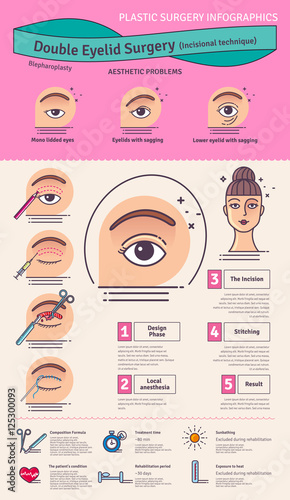 Vector Illustrated set with double eyelid surgery