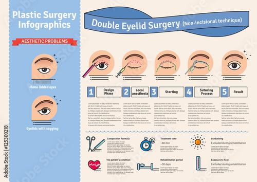 Vector Illustrated set with double eyelid surgery. Non-incisional technique