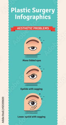Vector Illustrated set with aesthetic problems for eyelid surgery