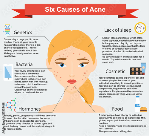 Causes of acne. Skin problems and diseases beauty infographics