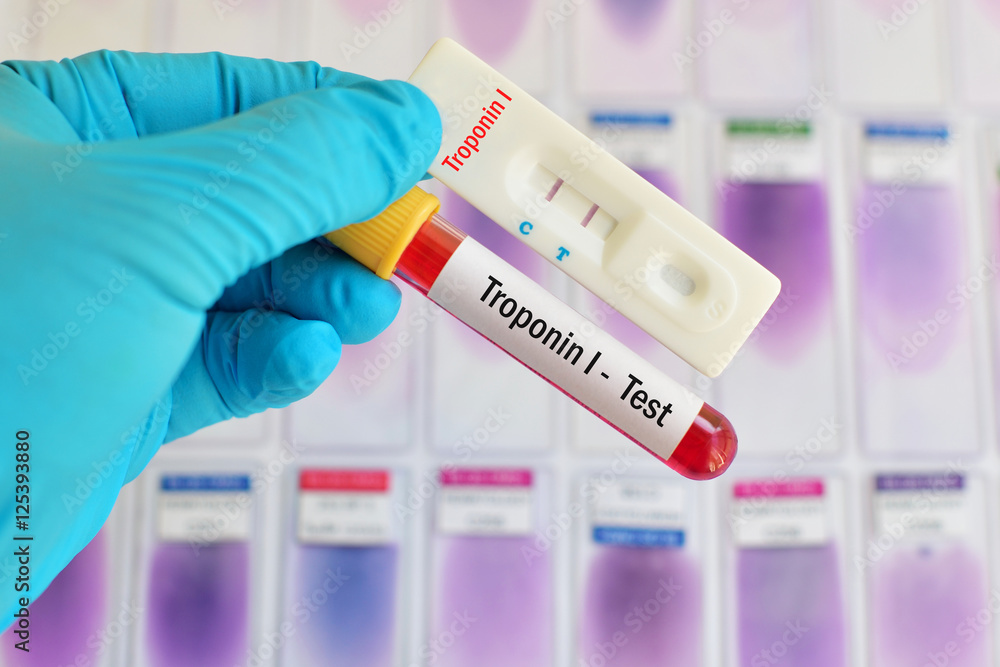 Troponin I testing by using rapid test cassette
Troponin I testing by using rapid test cassette