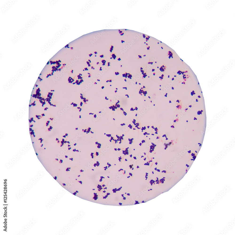 Blue gram positive cocci on white background. Blue gram positive cocci on white background.