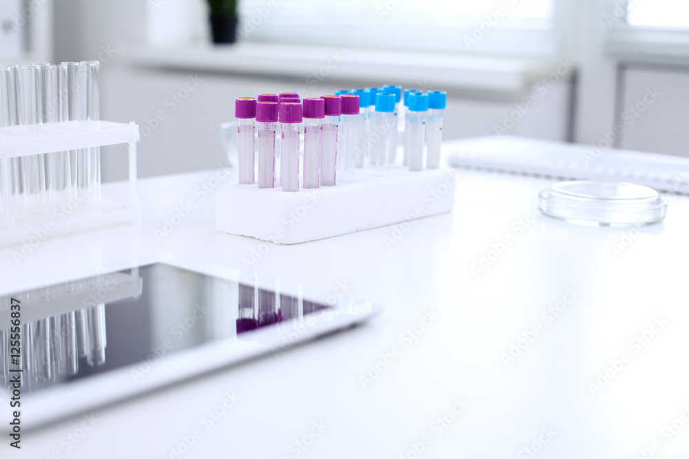 Research laboratory working space. Test tubes and tablet PC are lying at the table. Medical equipment. Blood test Research laboratory working space. Test tubes and tablet PC are lying at the table. Medical equipment. Blood test