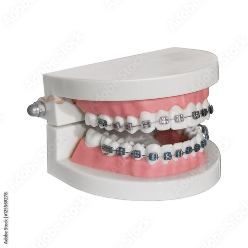 Dental jaw model isolated on white background