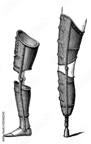 Artificial Legs, vintage engraving