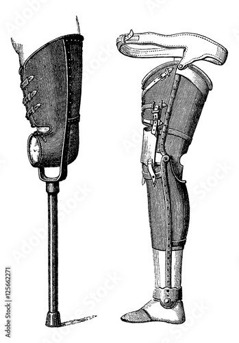 Artificial Legs, vintage engraving