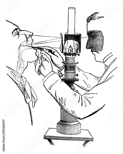 Laryngoscope, vintage engraving
