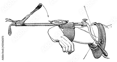 Charriere device, vintage engraving.