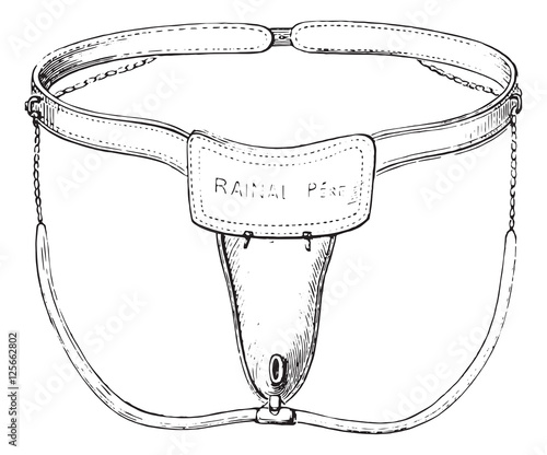 Device against masturbation in girls, vintage engraving.