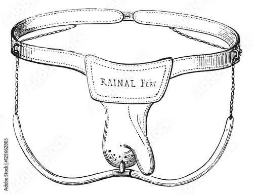 Device against masturbation in boys, vintage engraving.