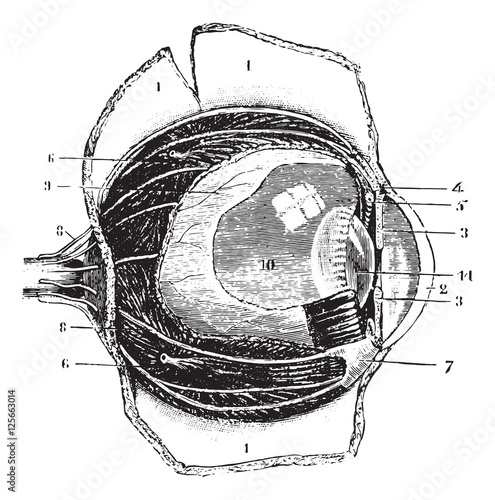 Cutting the antero-posterior eye, vintage engraving.