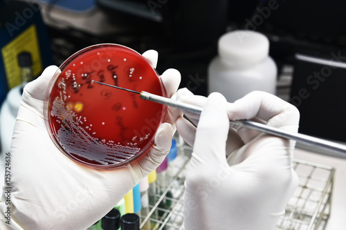  bacterial culture and drug resistance of pathogens in laborator photo