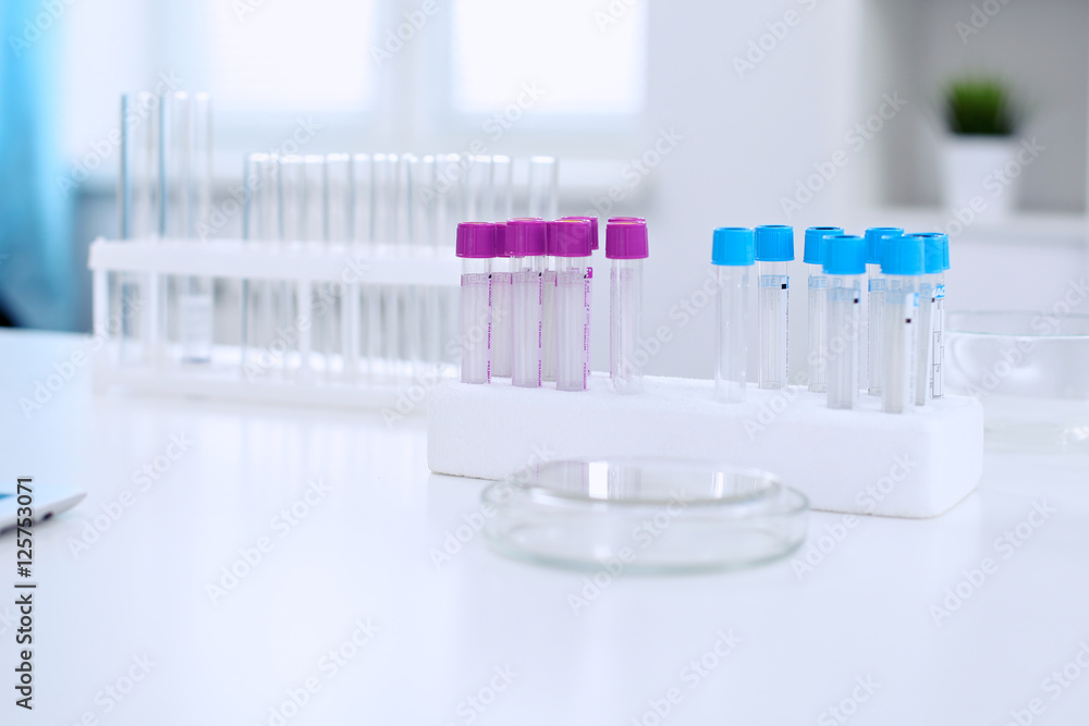 Research laboratory working space. Test tubes and tablet PC are lying at the table. Medical equipment. Blood test Research laboratory working space. Test tubes and tablet PC are lying at the table. Medical equipment. Blood test