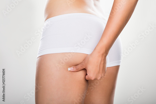 Woman Pinching Excessive Fat Of Buttock