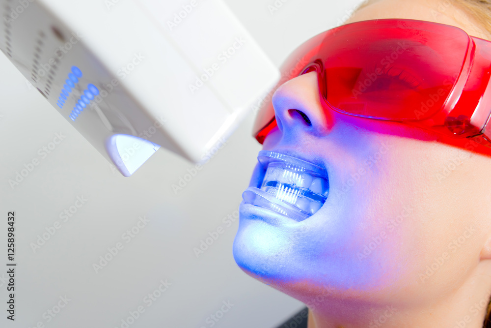 Fototapeta premium Closeup of lady receiving dental treatment