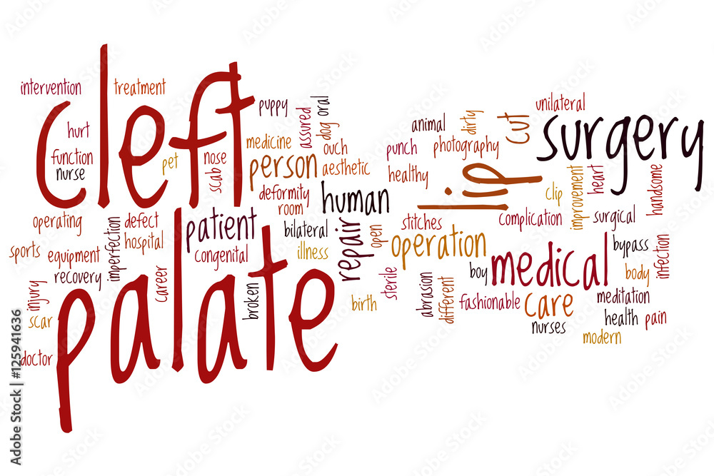 Cleft palate word cloud