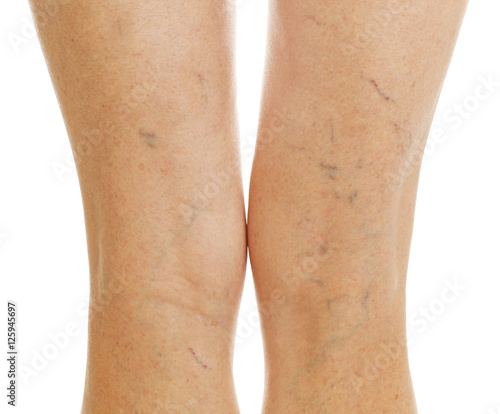 Female legs on white background, closeup photo