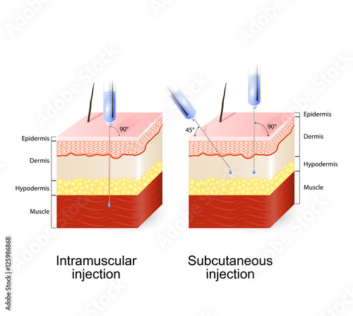 Intramuscular injection and Subcutaneous injection