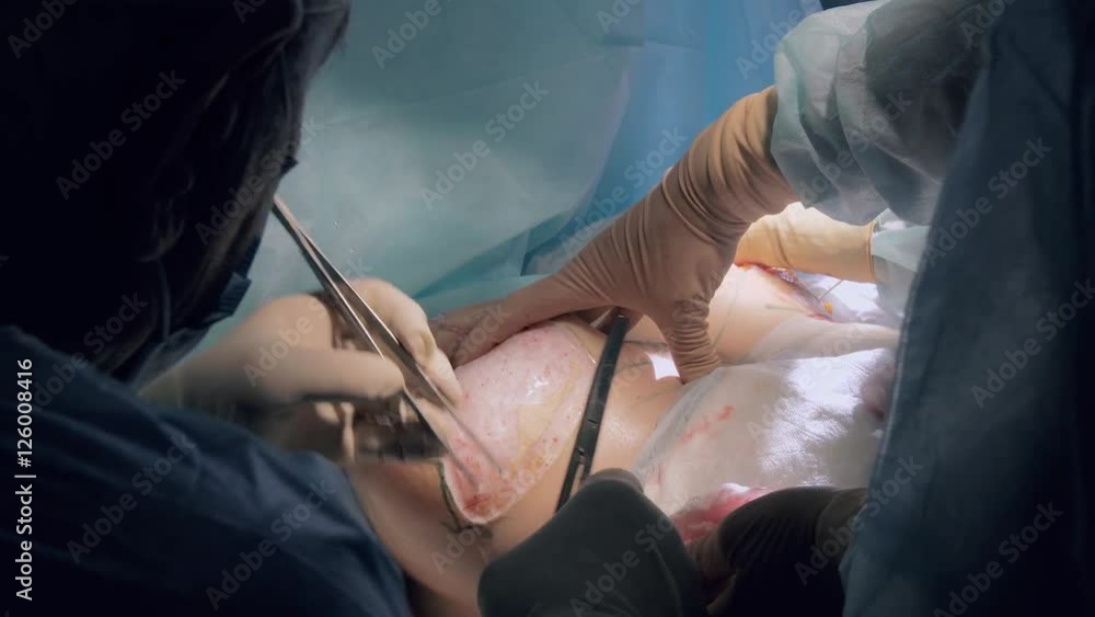 Professional surgeon performing an implants implantation in sterile conditions Professional surgeon performing an implants implantation in sterile conditions