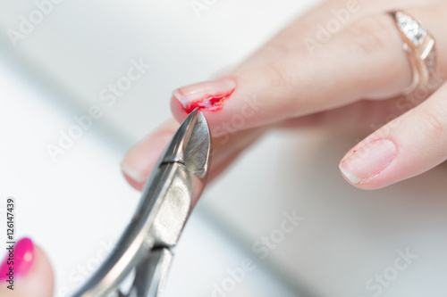 the girl suffered a cut finger on the manicure.