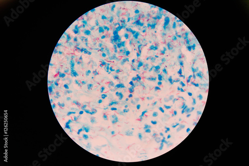 Mycobacterium tuberculosis