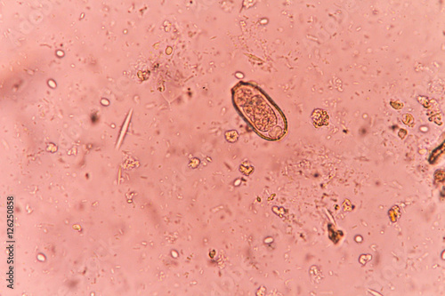 The egg of capillaria philinensis in stool exam photo