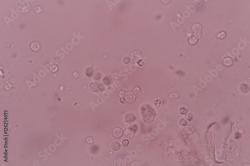 white blood cell in urine