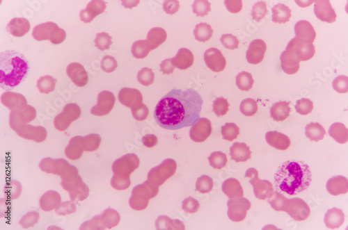plasma cell human blood cell under microscope,complete blood count.