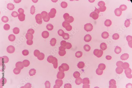 Blood smear show Rouleaux formation for complete blood count